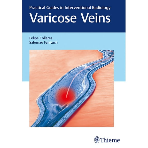 Varicose Veins: Practical Guides in Interventional Radiology (Hardcover)