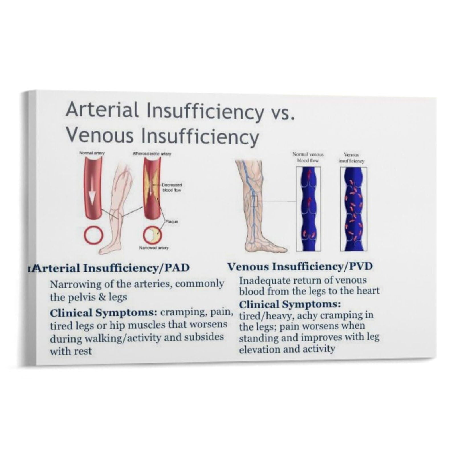 Varicose Veins Risk Signs And Symptoms Infographic Guide Medical ...