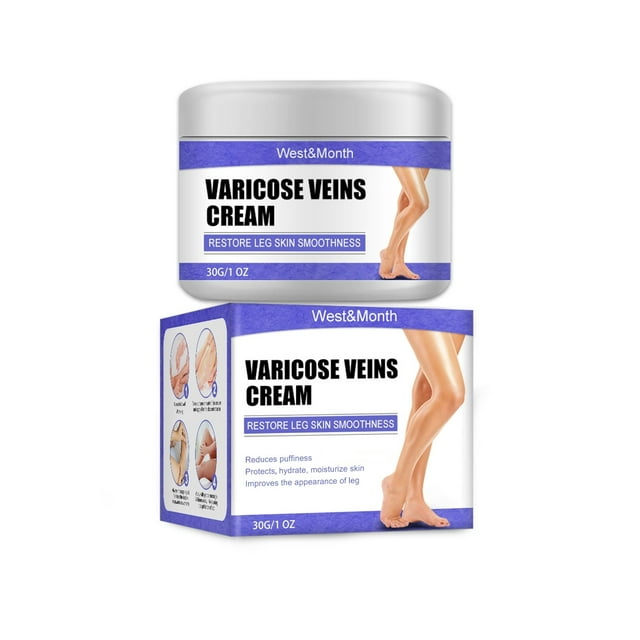 Varicose Veins Treatment for Legs, Natural Varicose Veins Cream