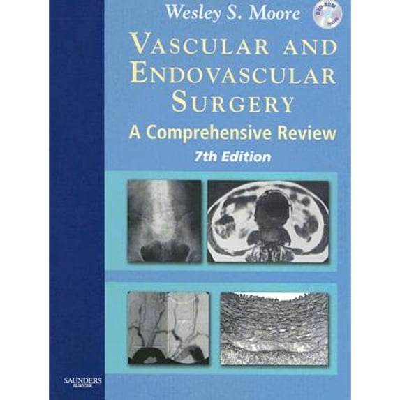 Vascular and Endovascular Surgery: A Comprehensive Review Expert Consult: Online and Print (Hardcover) by Wesley S Moore
