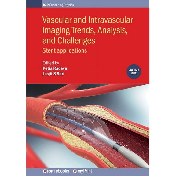 Vascular and Intravascular Imaging Trends, Analysis, and Challenges, Volume 1: Stent applications, (Paperback)