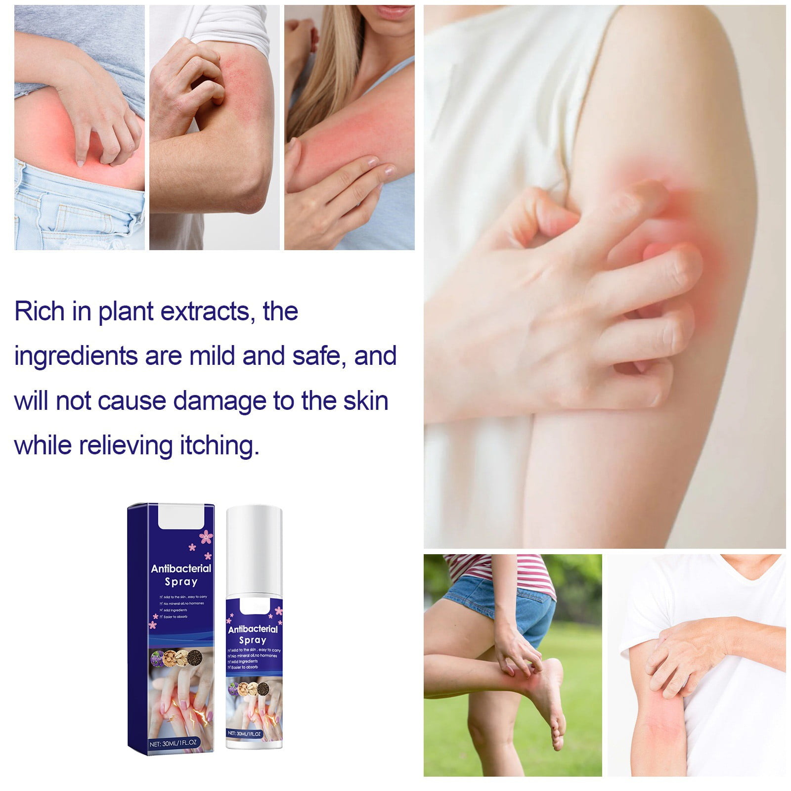 Vegan Skincare Options Viola Vulgaris Spray Skin Skin Itchy Skin