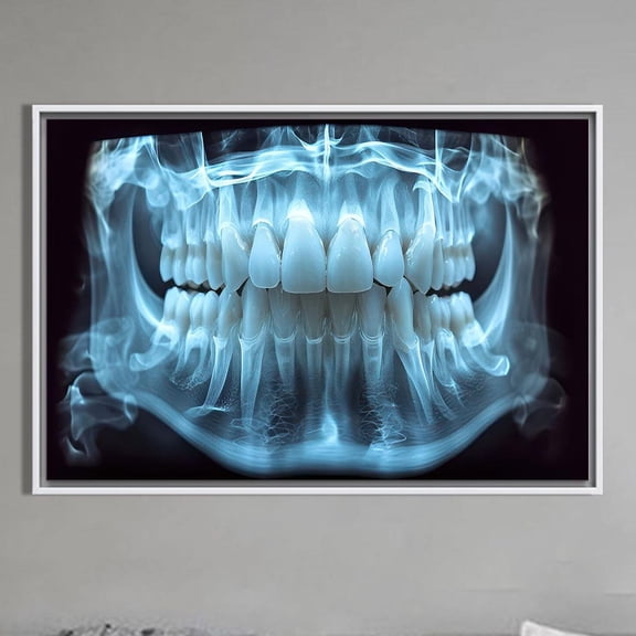 Velto Dental X-Ray Art Canvas, Anatomical Teeth Wall Art, Blue Radiograph Canvas, Dentist Office Decor, Dental Clinic Wall Print Canvas, 16x24 UNFRAMED