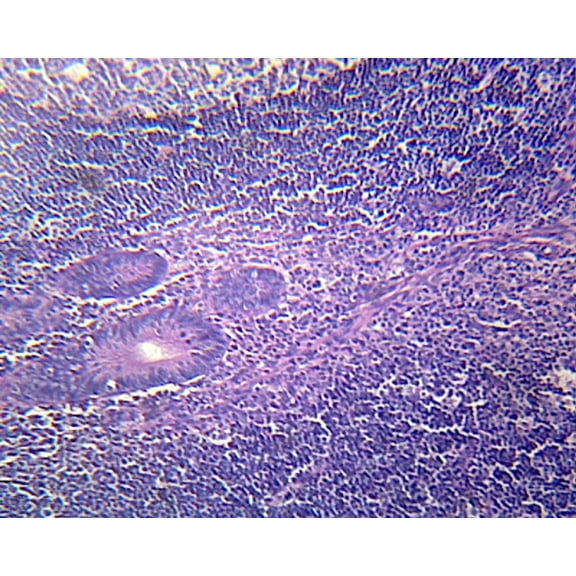 Vermiform Appendix; Section by Go Science Crazy