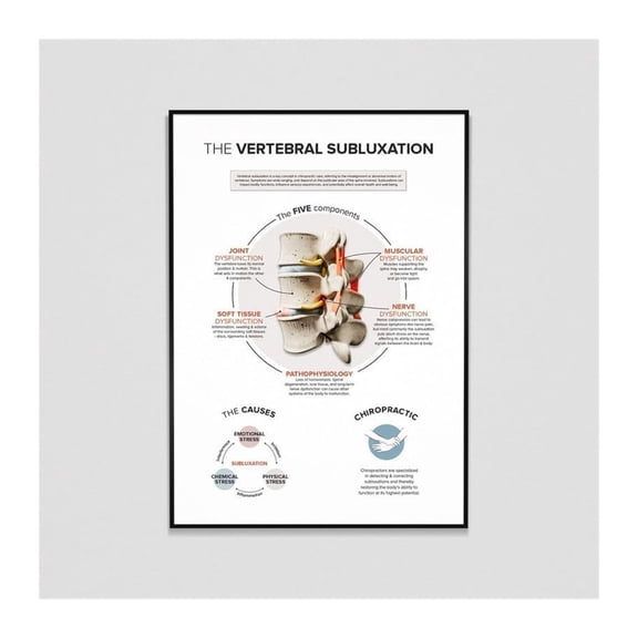 Vertebral Subluxation Complex Poster Canvas Painting Spine Anatomy Chart Five Components Joint Nerve Muscle Dysfunction Wall Art Clinic Office Decor