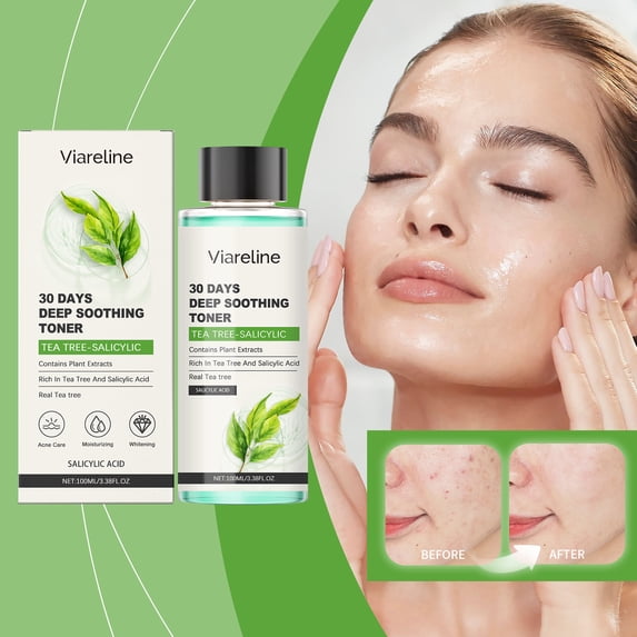 Viareline Salicylic Acid Toner, Gently Moisturizes Tender Skin Moisturizing Refreshing Daily Wet Compress Essence