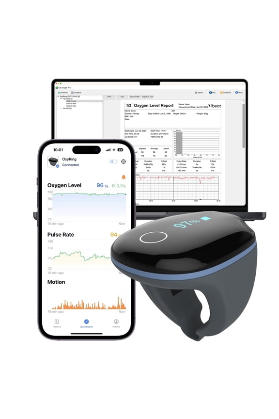 O2Ring Continuous Oxygen Monitor - Bluetooth Pulse Oximeter with Vibration Reminder & Free PC Report, Wearable Finger Oxygen Meter for Athlete/Fitness