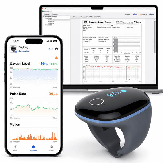Wellue O2ring Sport Pulse Oximeter Wearable Blood Oxygen & Heart Rate Monitor Bluetooth Ring for Sports Aviation Hiking Cycling Yoga