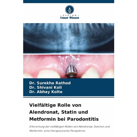 Vielfltige Rolle von Alendronat, Statin und Metformin bei Parodontitis, (Paperback)