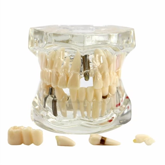Vigor - Dental Teeth Model Brackets Study Implant Pathological Disease Restoration Teach