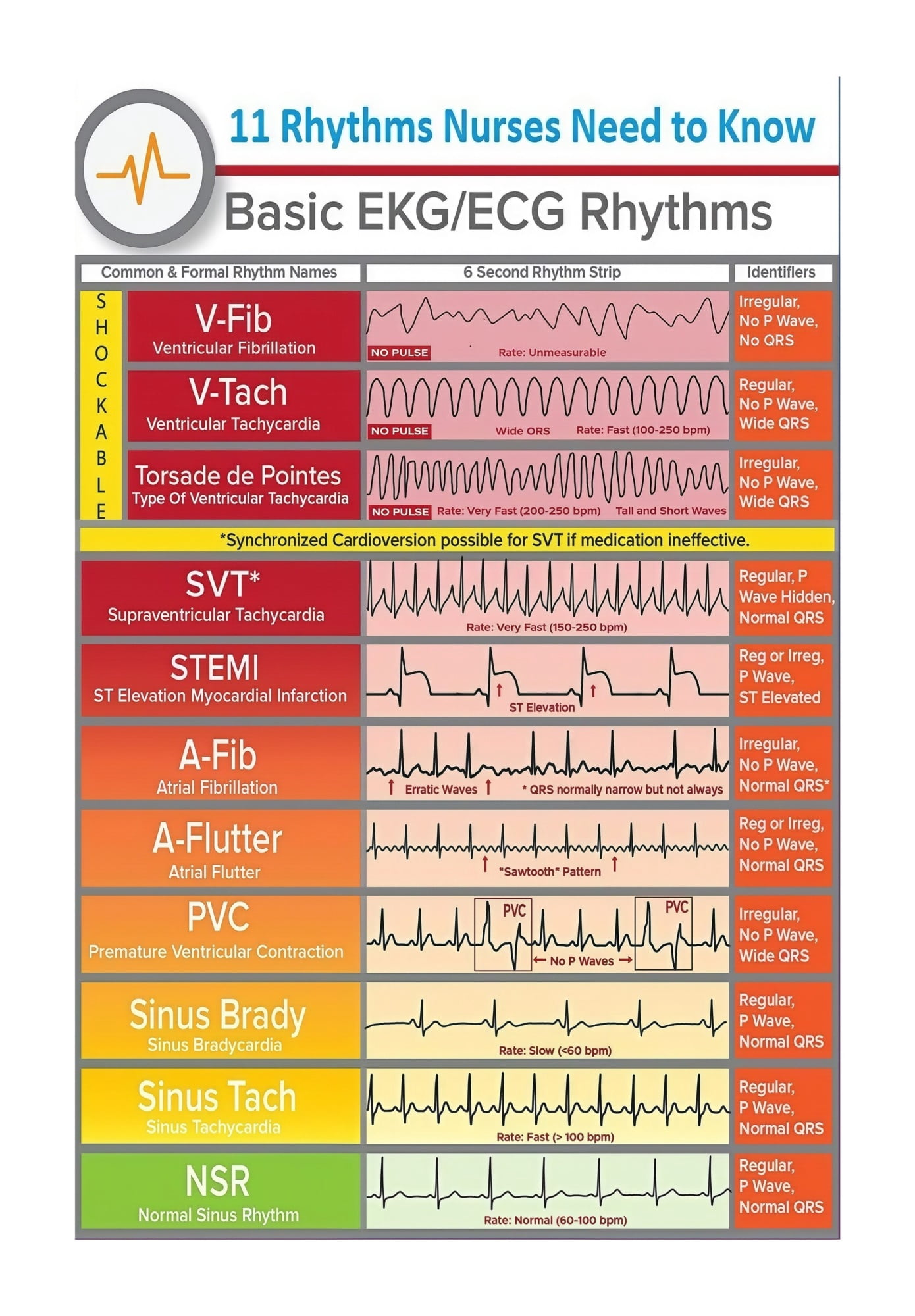 Heart Rhythem Posters Vintage Medical Wall Art Cardiovascular and EKG Heart Rhythm Chart ...