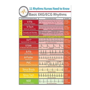Vintage Medical Wall Art Cardiovascular and EKG Heart Rhythm Chart Educational Poster for Doctor Office Study Room and Home Decor