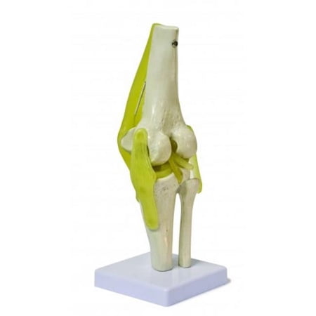 Vision Scientific Knee Joint Model