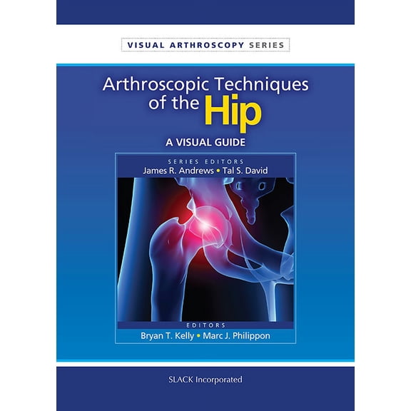 Pre-Owned Visual Arthroscopy: Arthroscopic Techniques of the Hip : A Visual Guide (Paperback)