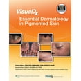thumbnail image 1 of Visualdx: The Modern Library of Visual M Visualdx: Essential Dermatology in Pigmented Skin, (Hardcover), 1 of 1