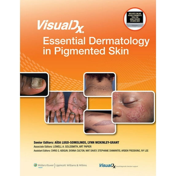 Visualdx: The Modern Library of Visual M Visualdx: Essential Dermatology in Pigmented Skin, (Hardcover)