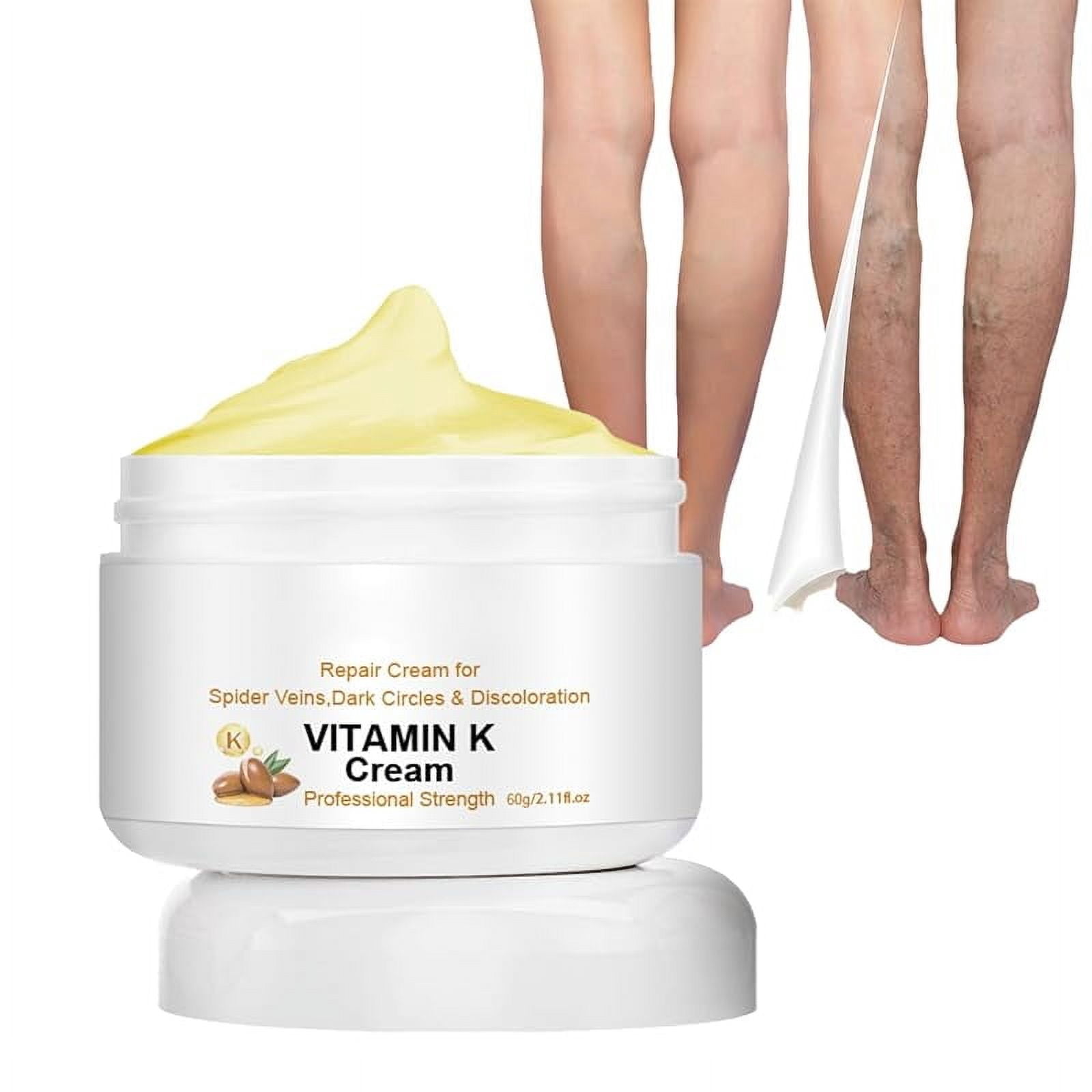 Vitamin K Cream, Varicose Veins Miracle Cream, Spider Varicose Veins Miracle Cream, Remove Varicose Veins for Legs