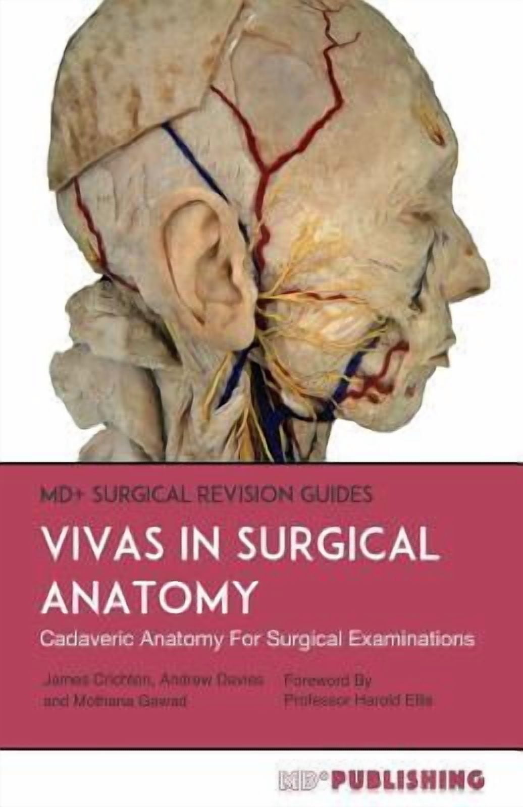 MD+ Surgical Revision Guides: Vivas In Surgical Anatomy: Cadaveric Anatomy Vivas For Surgical Examinations (Paperback)