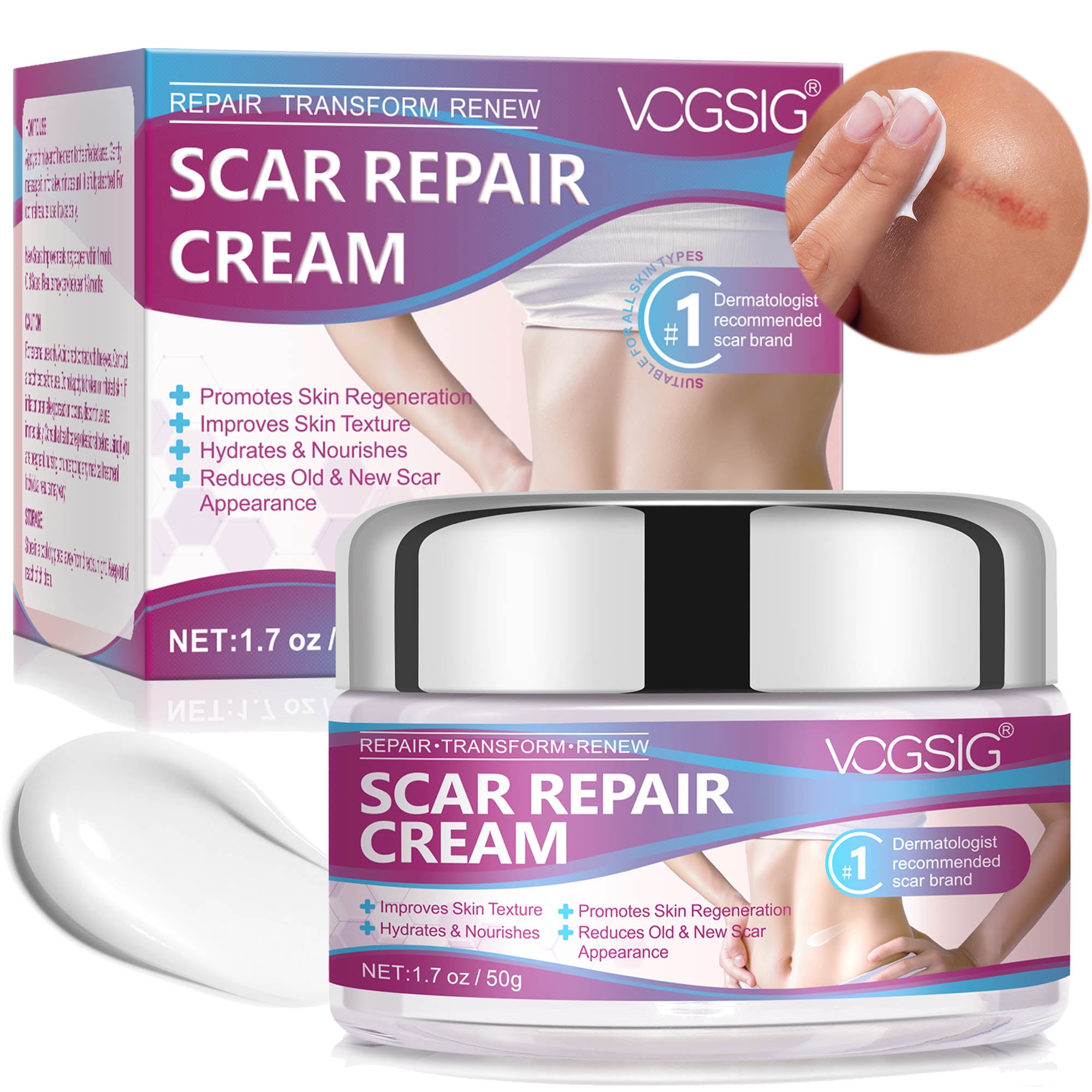 Vogsig Scar Cream - Soften and Hydrate - For New and Old Scar - Prevents Pigmentation 50g/1.7oz