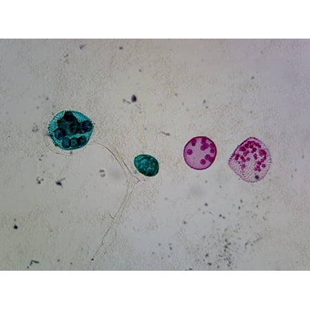 Volvox Sexual Reproduction; Showing Sex Cells; Whole-mount by Go Science Crazy