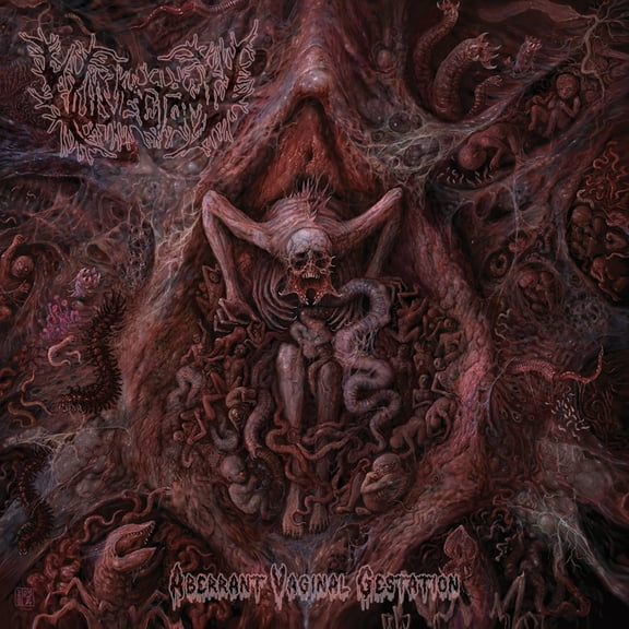 Vulvectomy - Aberrant Vaginal Gestation - Music & Performance - CD