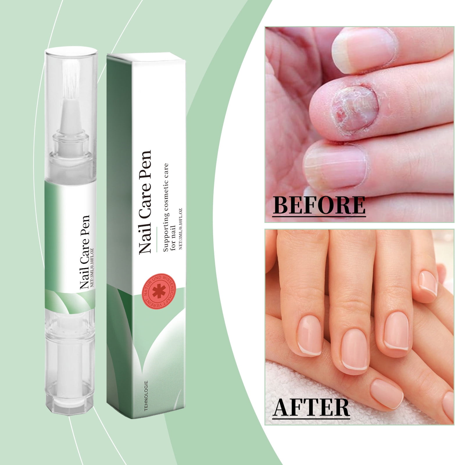 WCUCV Nail Biting Treatment for Kids, 3ml Nail Growth Care Solution Nail and Cuticle Care