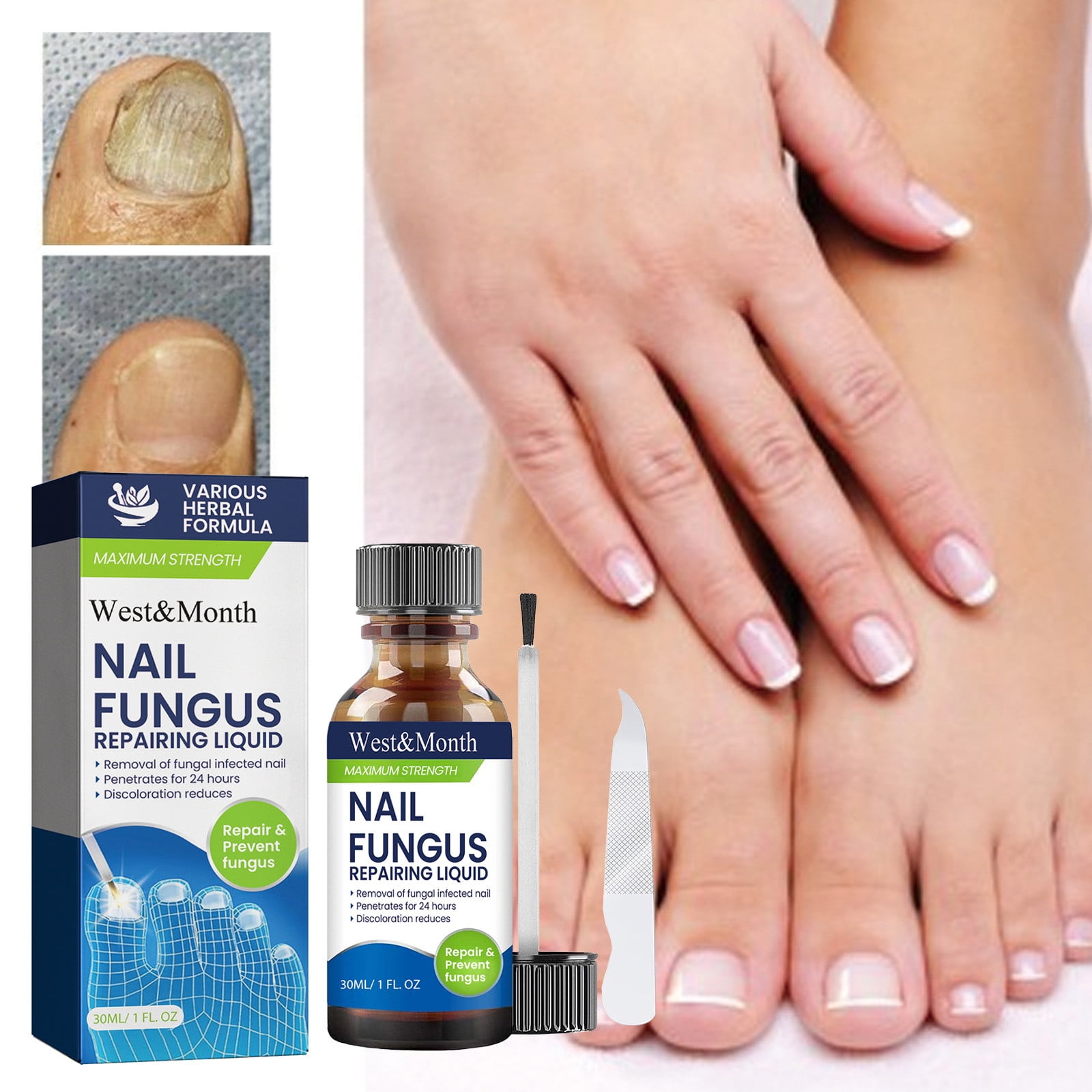 WCUCV Stop Nail Biting, Onychomycosis Solution, Thickening Bright