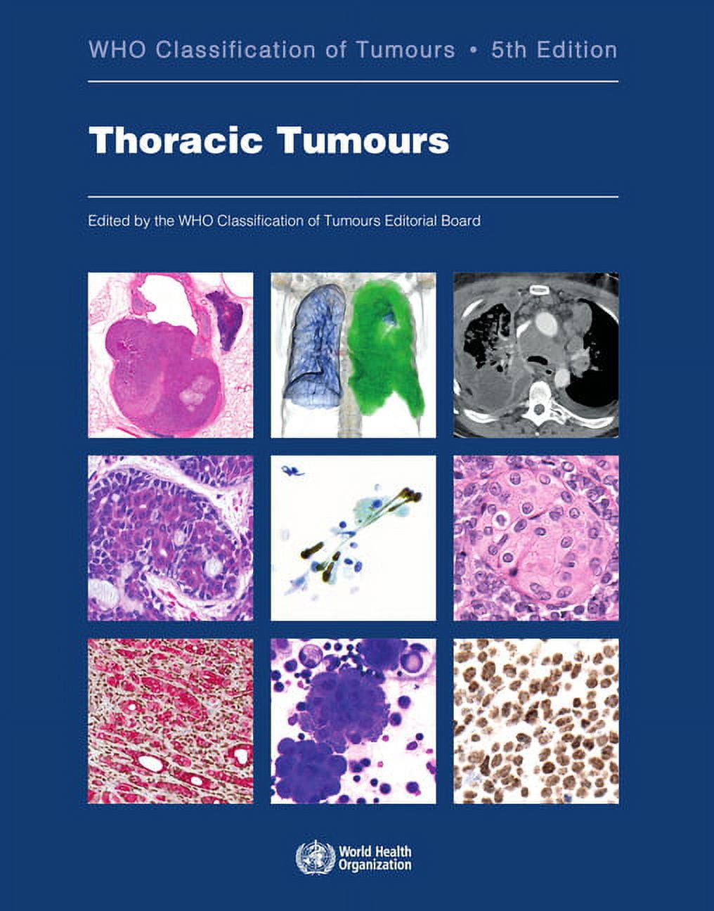 WHO Classification of Tumours: Thoracic Tumours: Who Classification of Tumours (Paperback)