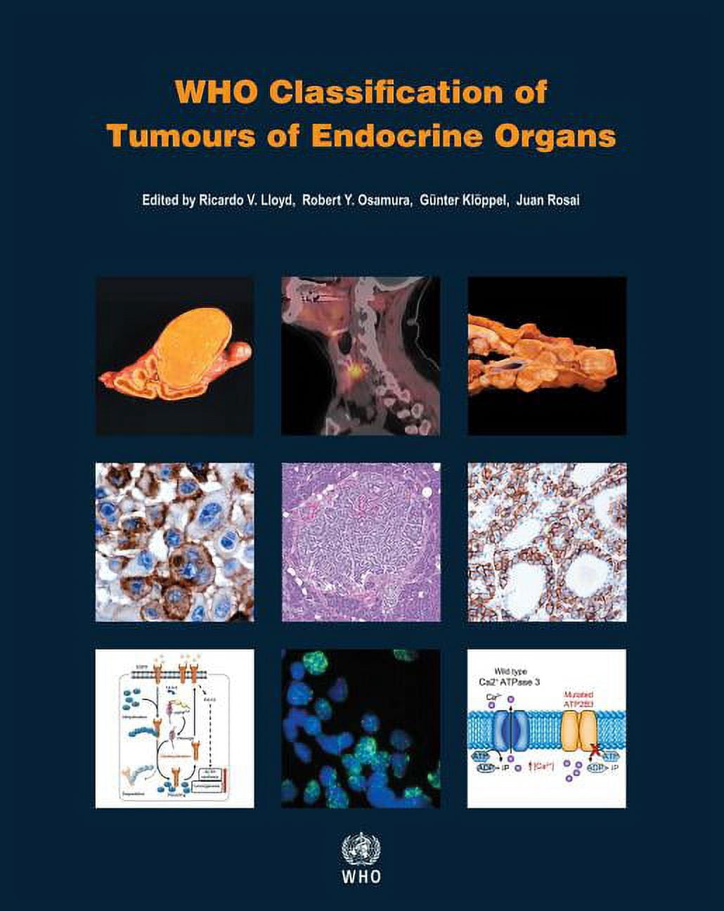 WHO Classification of Tumours Who Classification of Tumours of ...