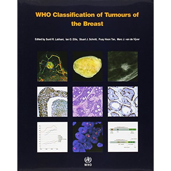 Pre-Owned Who Classification of Tumours of the Breast [op] (Paperback ...