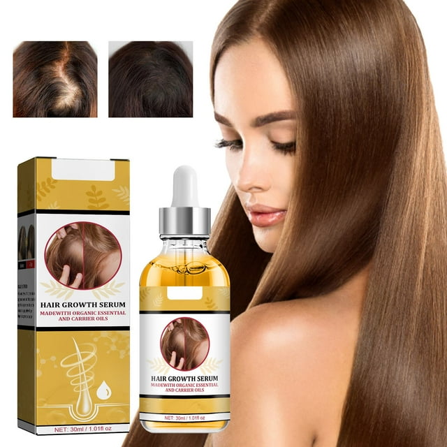 WNG Hair Growth Serums Hair Lotion for Men Women Hair Regrowth Lotion Hair Growth Care Hair Loss