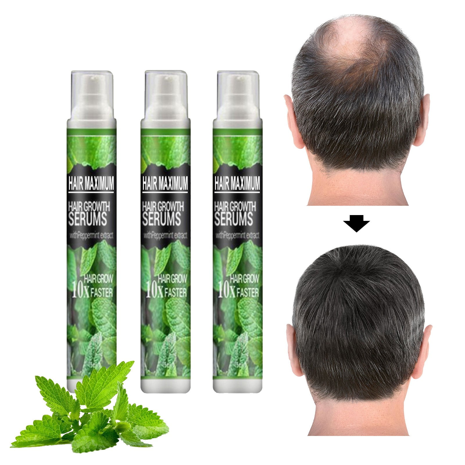 WNG Hair Herbal Spray Herb Growth Spray Hair Oil to Hair Loss Herbal