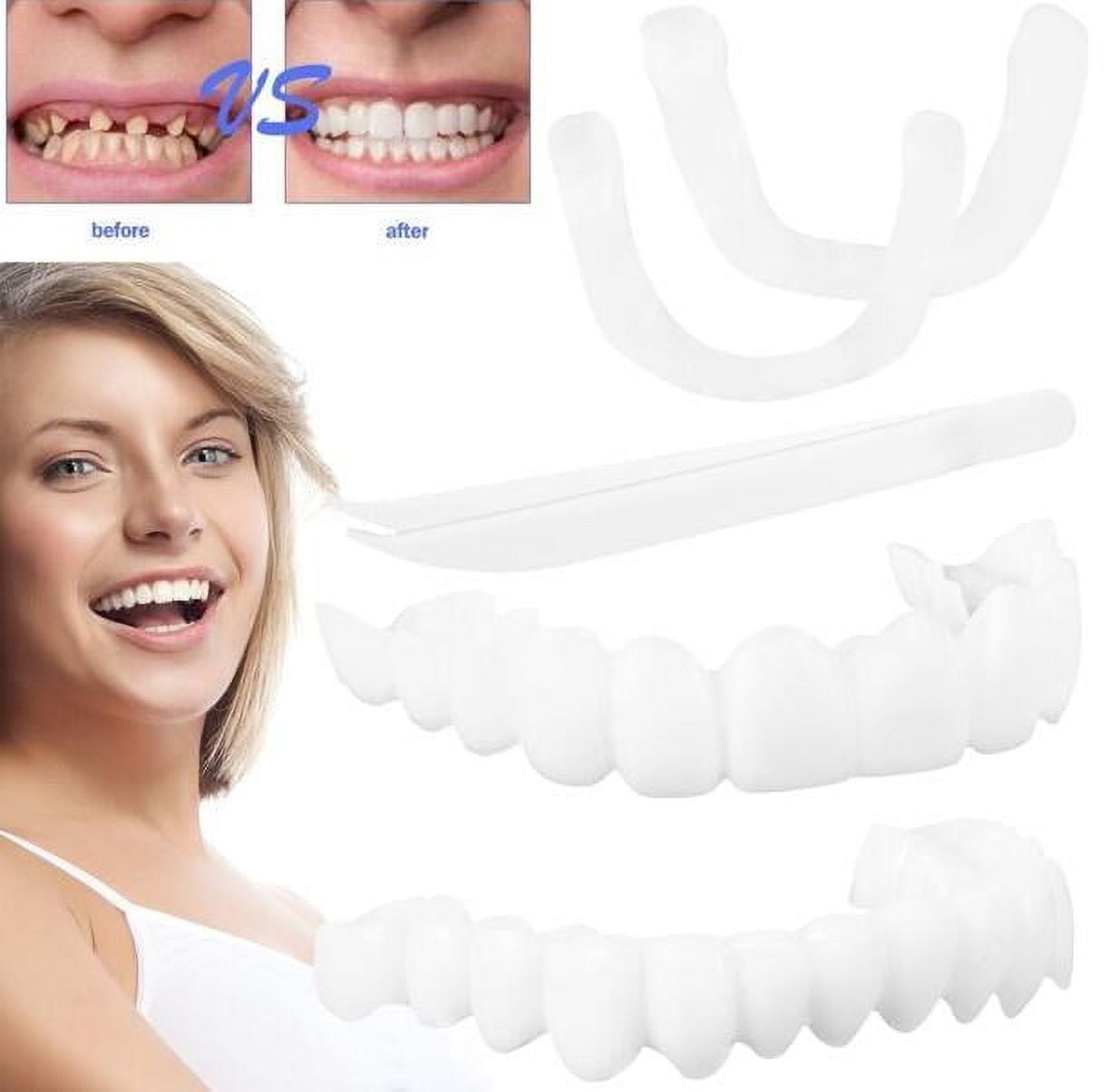 WNG New Braces Upper Teeth Lower Teeth Set Six Generations of