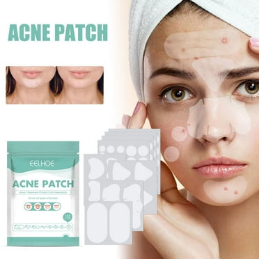 WUXICHEN Acne Pimple Patches, 8 Sizes 102 Patches For Large Zit Breakouts, Mandabloom Acne Patches For Face, Chin Or Body, Hydrocolloid Bandages Acne With Tea