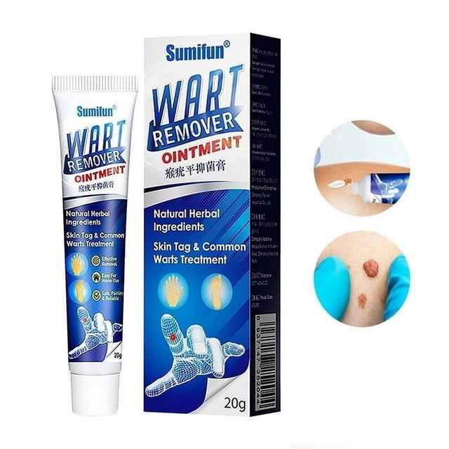 Walmart Wart Removal Ointment, AntiSkin Medical Cream for Body