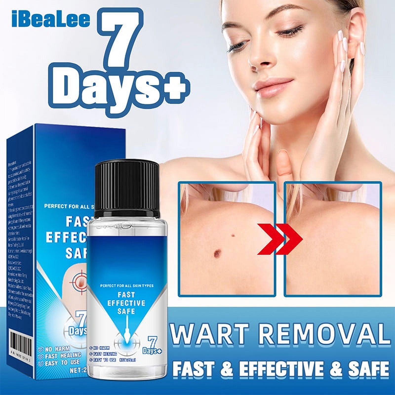 Wart Remover(removedor de verrugas) Fast and Effective Wart Remover for
