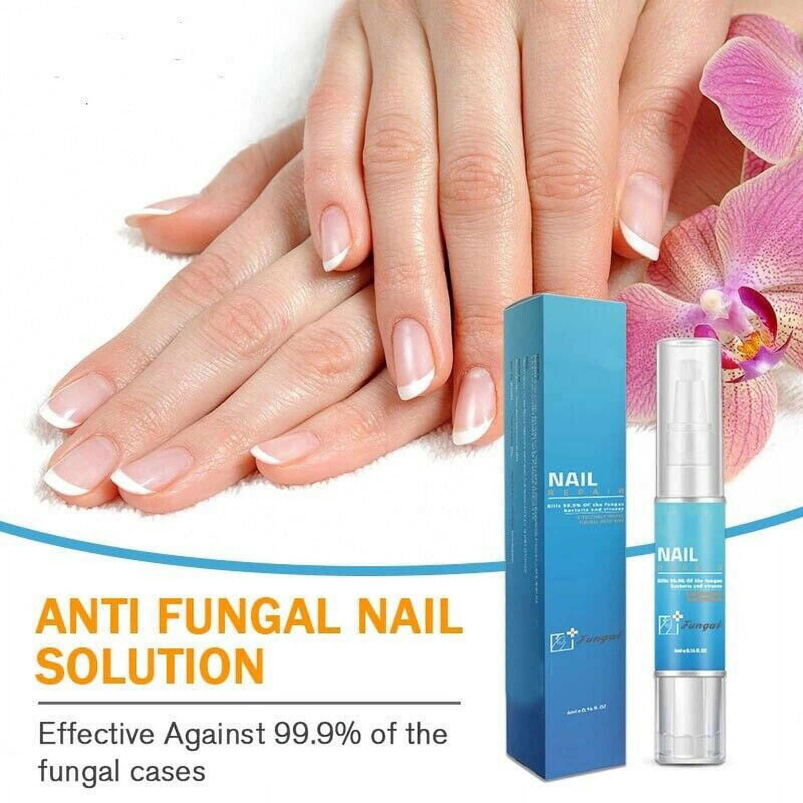 Wavespets Fungal Nail Treatment Pen Effective Onychomycosis Fungus  Infection Repair Gel Fingernails Care - Walmart.com