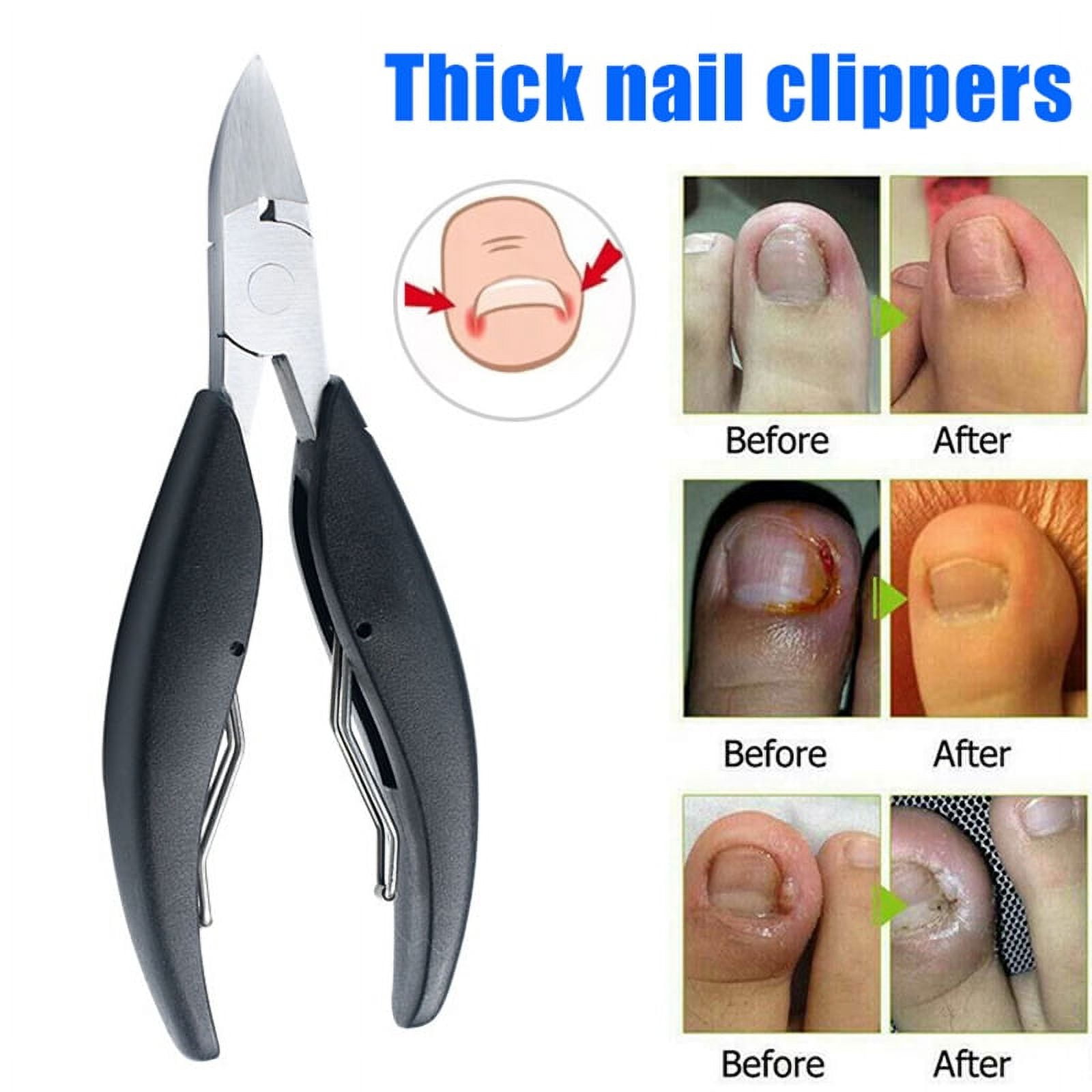 Toenail Clippers Podiatrist Thick Ingrown Heavy Duty Precision Nail  Scissors US