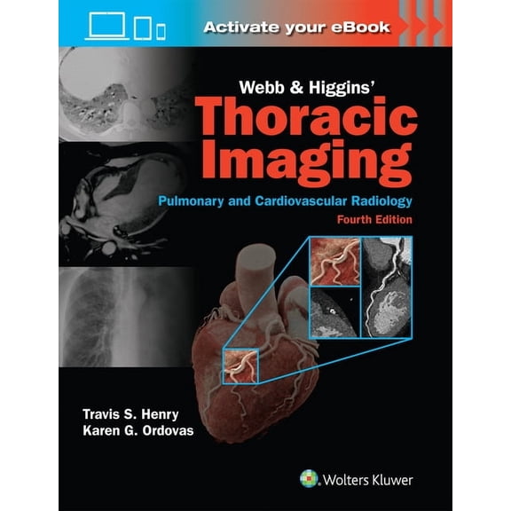 Webb & Higgins Thoracic Imaging: Print + eBook with Multimedia, (Hardcover)