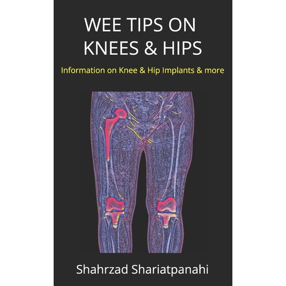 Wee Tips on Knees & Hips: Information on Knee & Hip Implants and More, (Paperback)