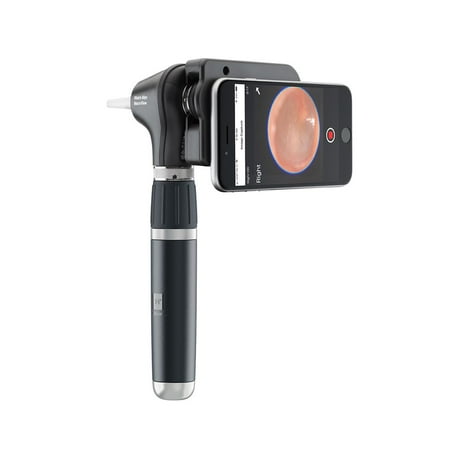 Welch Allyn 3.5V LED Macroview Plus Otoscope With Lithium Ion Rechargeable Handle, Iexaminer Smart, Soft Case