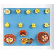 نموذج ويلدن التشريحي البشري التشريحي ونموذج التجانس المبكر