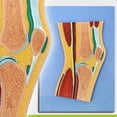 thumbnail image 1 of Wellden Medical Anatomical Knee Joint Section Model, 1 of 1