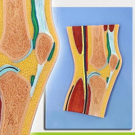 Wellden Medical Anatomical Knee Joint Section Model