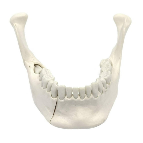Wellden Medical Anatomical Lower Jaw with Extractable Teeth Model