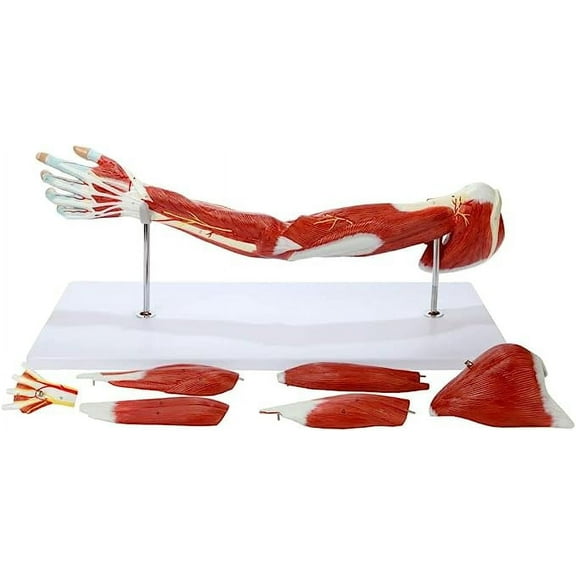 Wellden Product Medical Anatomical Muscular Arm Model, 7 Parts, Life Size