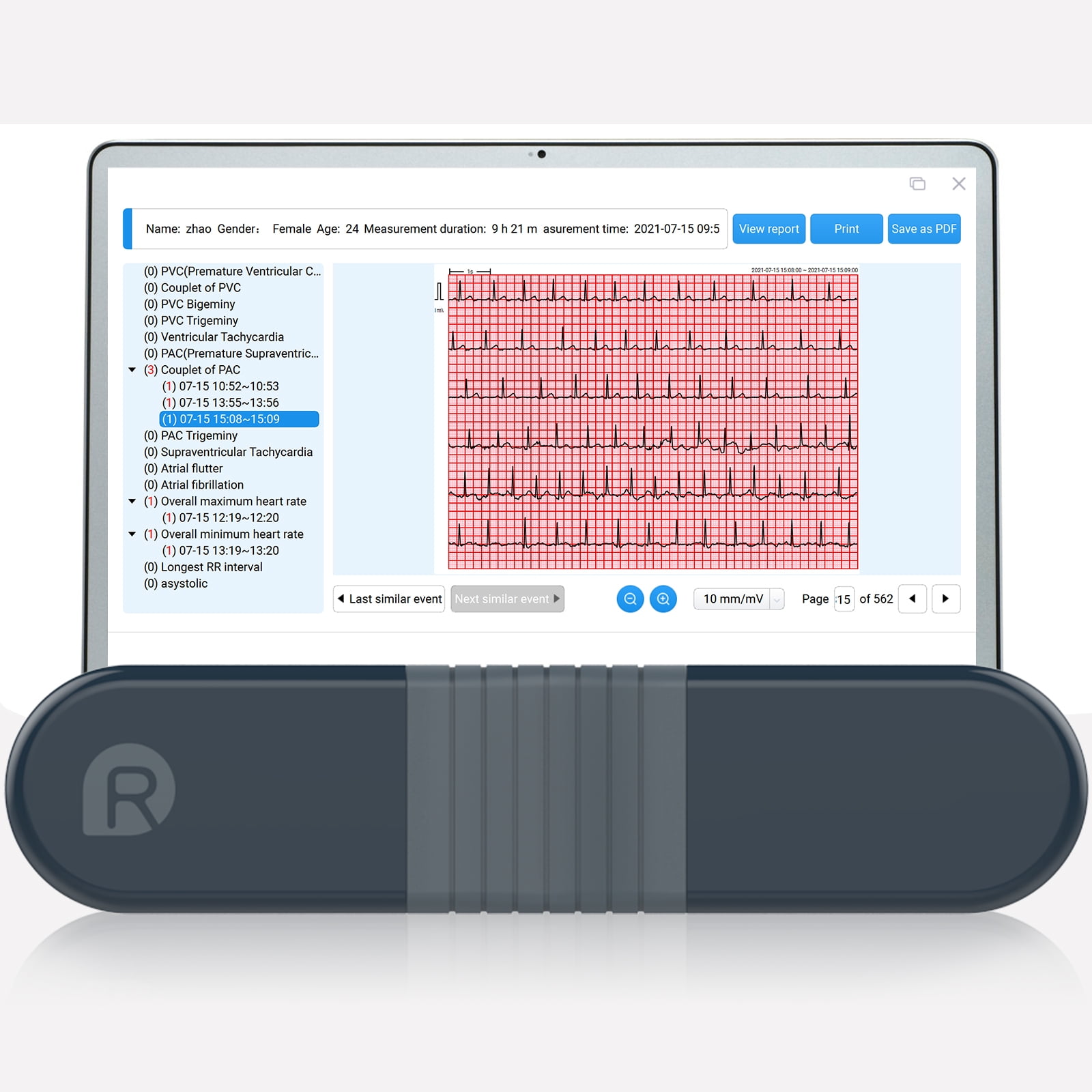 Wellue Personal EKG Monitor with AI Analysis,24 Hours ECG Heart Health Monitor for Sleep and Exercise,Home Heart Rate Recorder,Free PC Report Sansujyuku sansujyuku.com