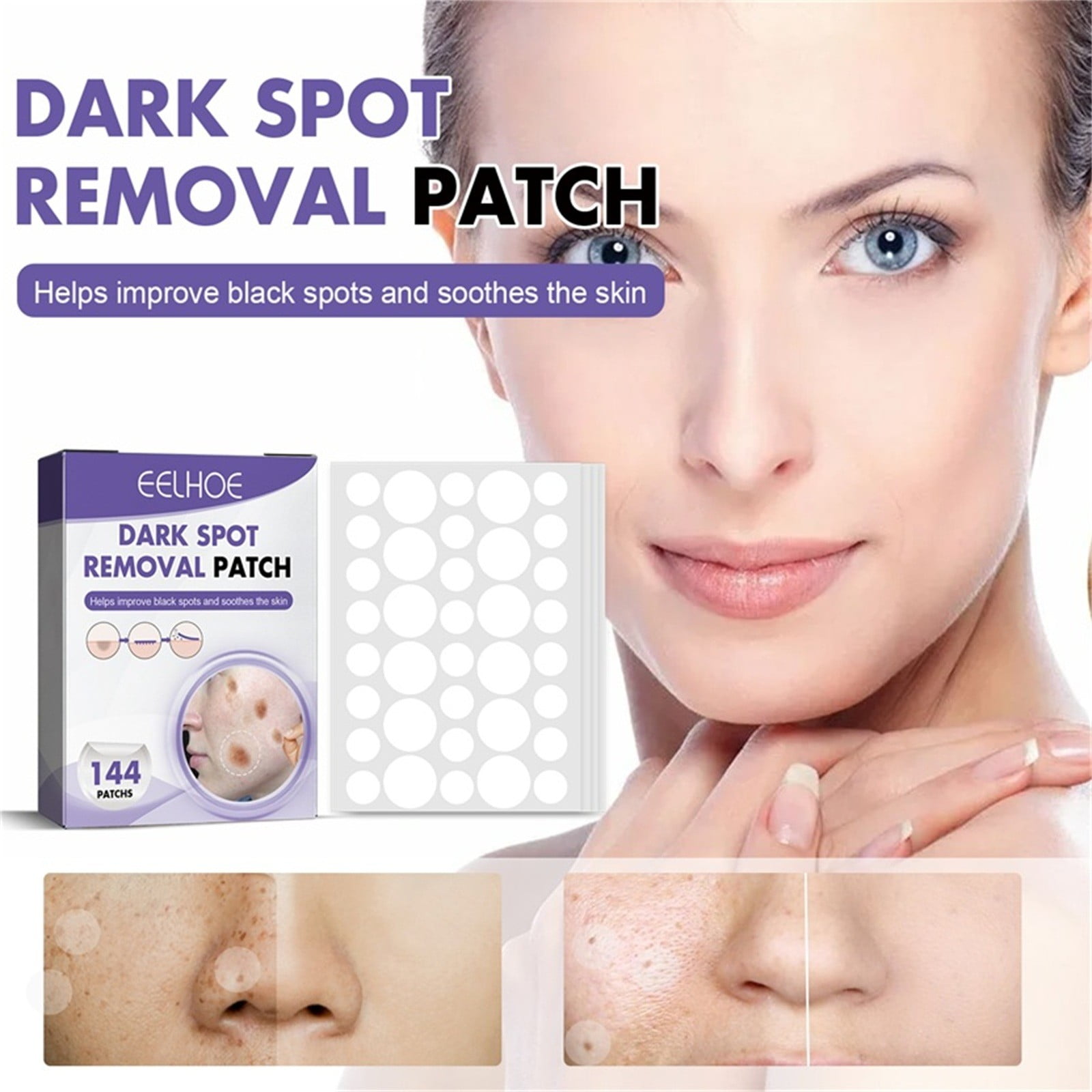 Weloille 144Pcs Hydrogel Patches Dark Spot, Old Age Spot Care Patches