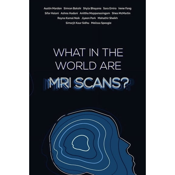 What in the world are MRI Scans?, (Paperback)