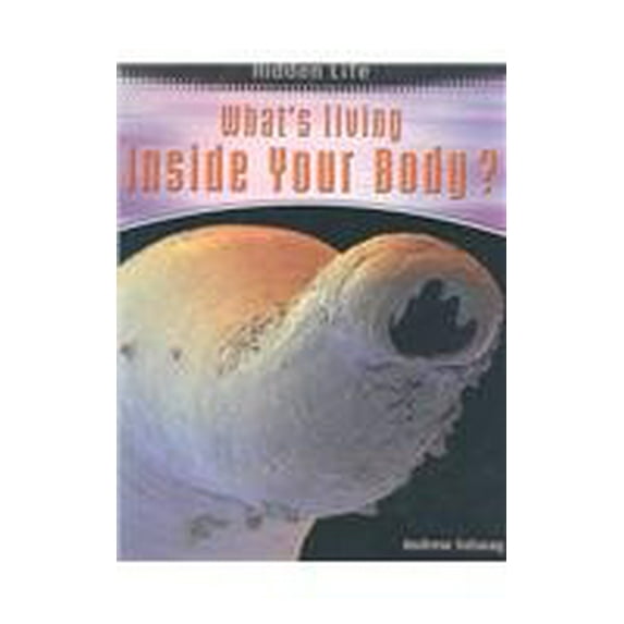 Pre-Owned Whats Living Inside Your Body? Hidden Life Paperback Andrew Solway